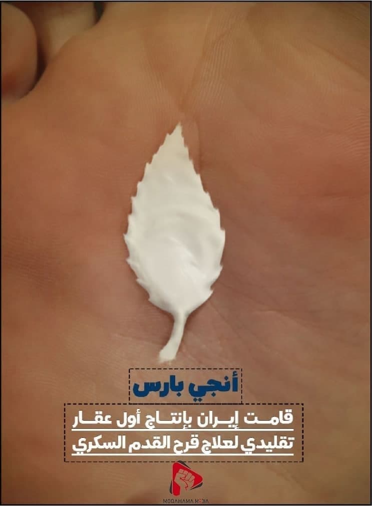 أنجي بارس